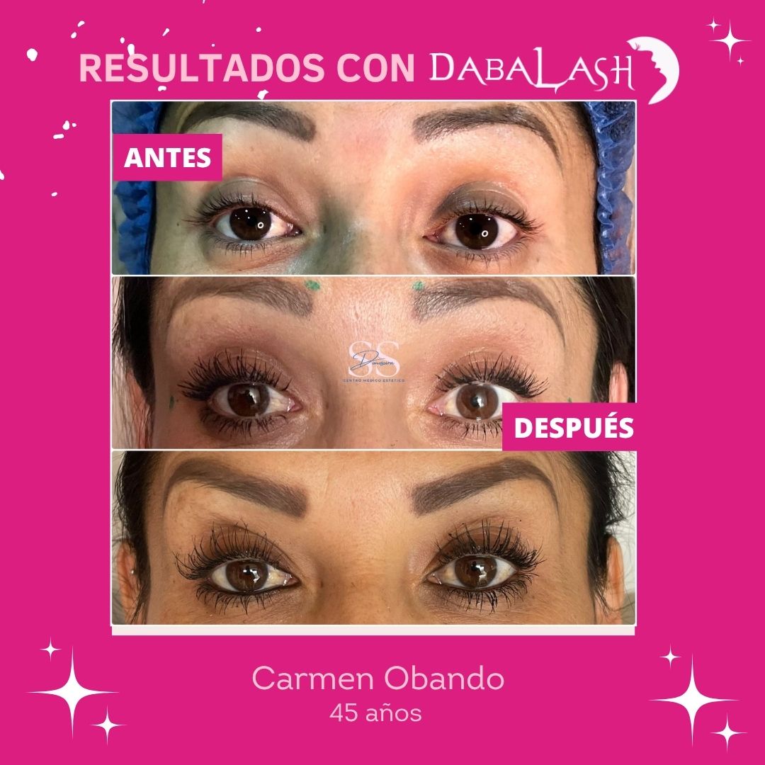 Testimonios de crecimiento de pesta&ntilde;as 